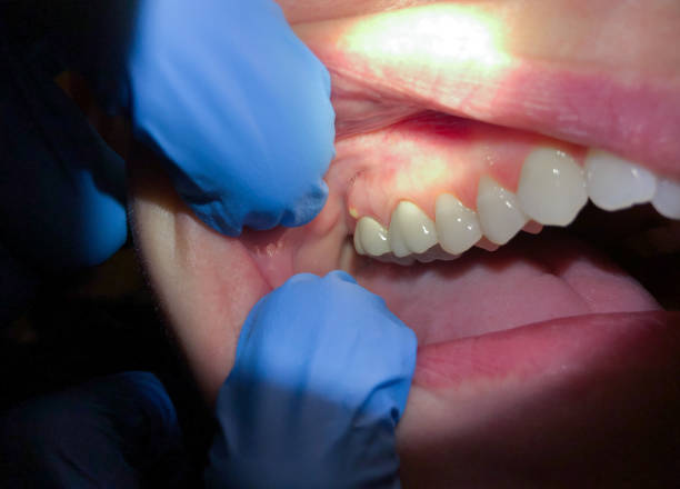Best After-Hours Emergency Dentist in Logan, IA