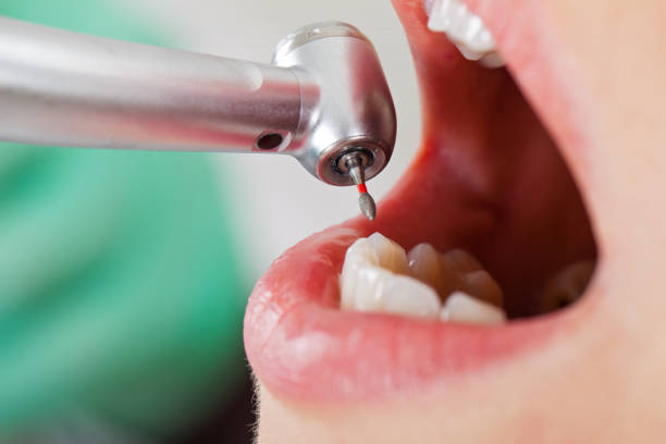 Best Weekend Emergency Dentist in Logan, IA